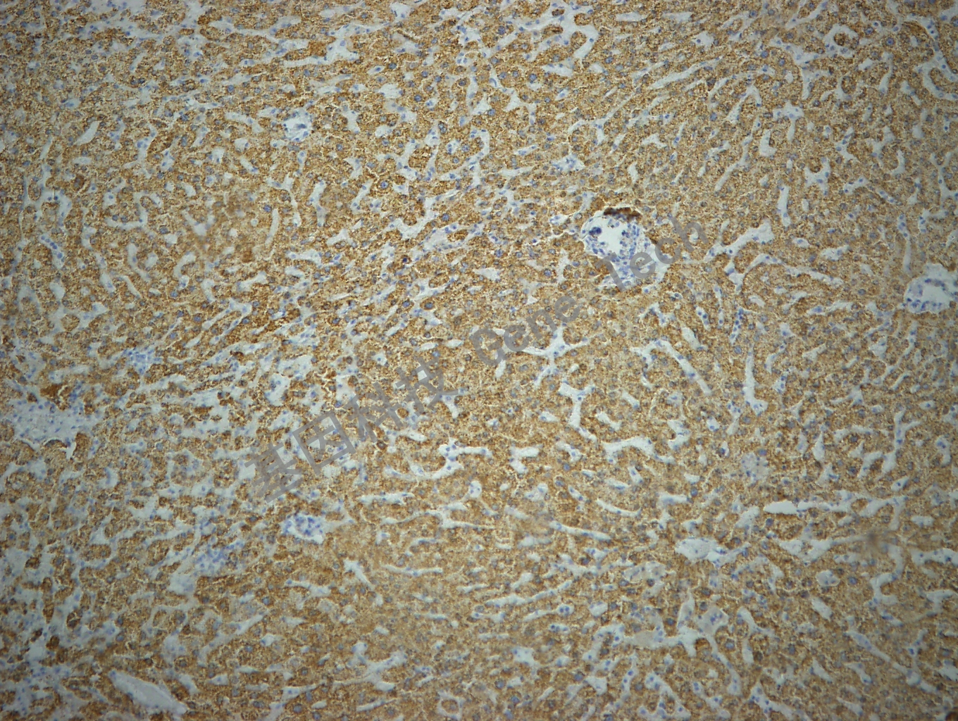 hepatocyte GM7158 肝癌1 10X_副本.jpg