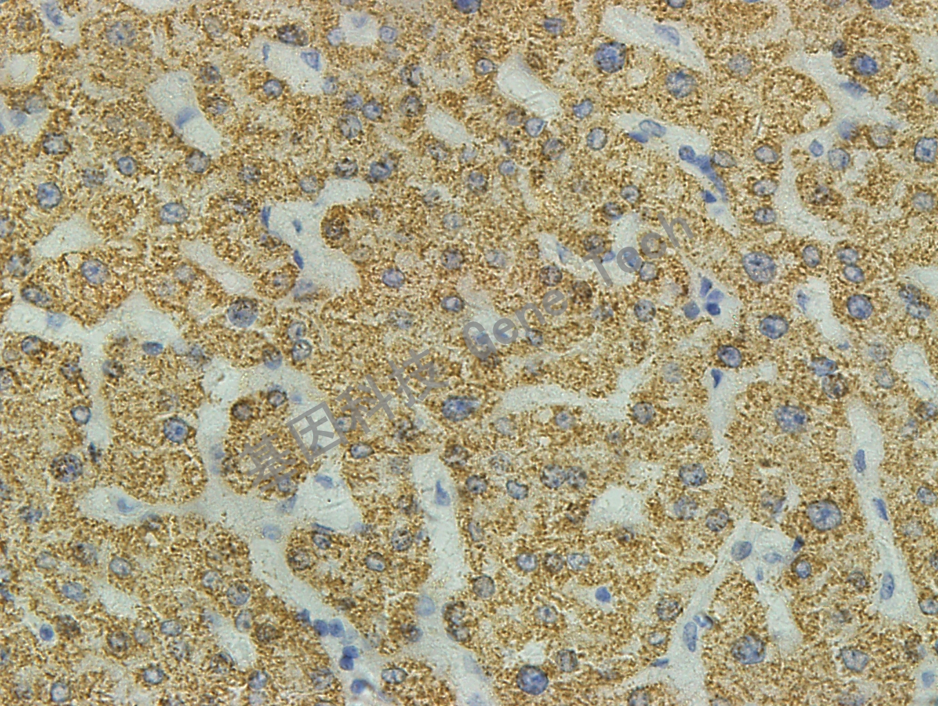 hepatocyte GM7158 肝癌1 40X_副本.jpg