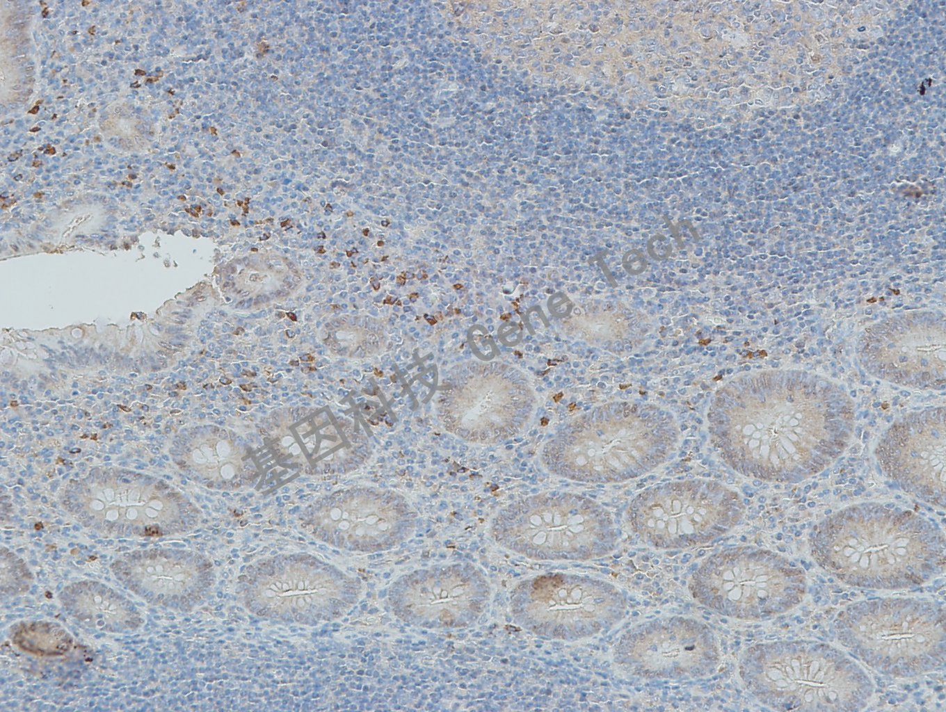 20190507-9 HNF1B 07-T24 阑尾-3_副本.jpg