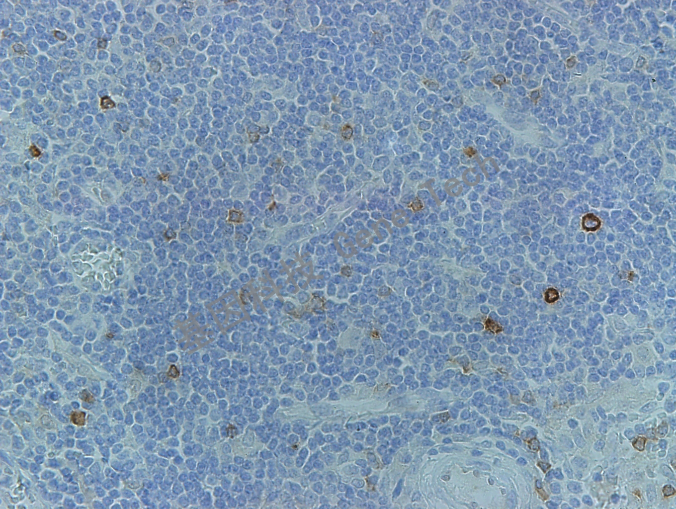 IMP3 GT2261 淋巴结 40X_副本.jpg