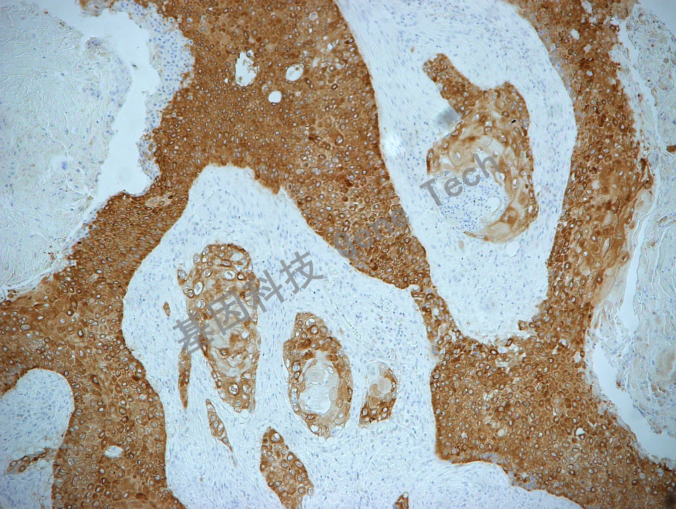 IMP3 GT2261 食管癌 10X_副本.jpg