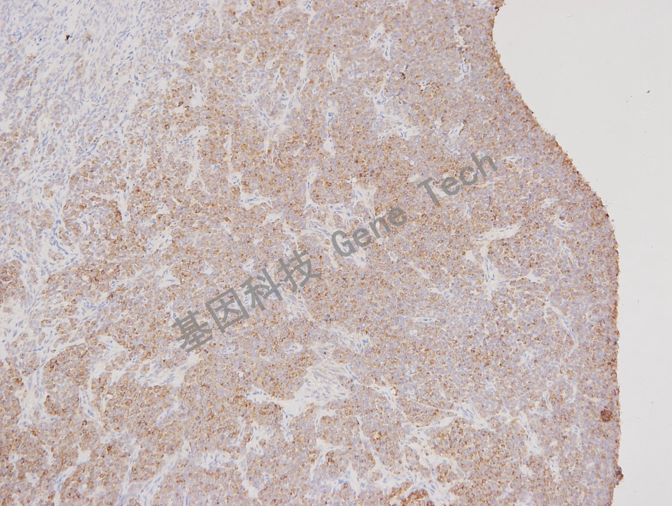 GT2302 inhibinA 卵巢_副本.jpg