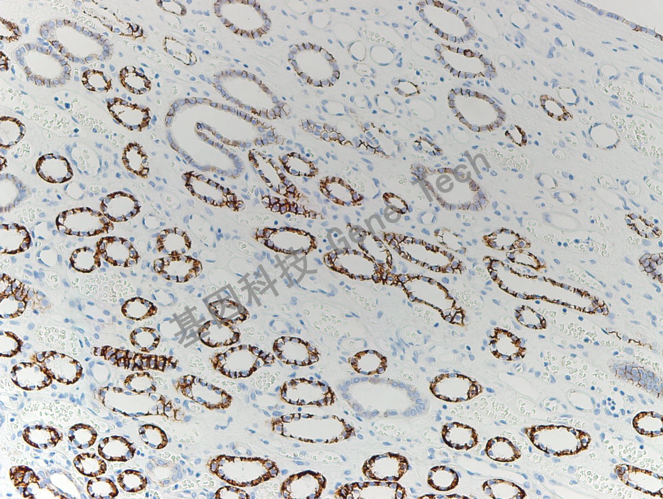 ksp-cadherin 正常肾-2_副本.jpg