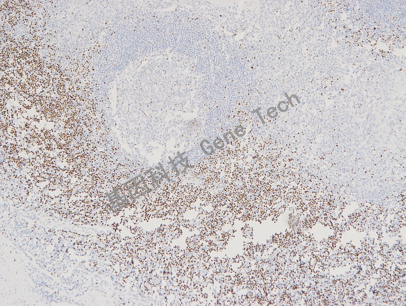 GT2301 扁桃体1_副本.jpg