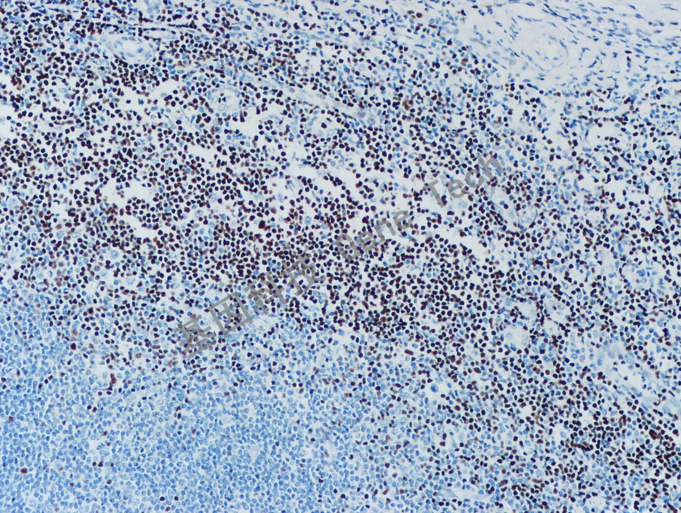 LEF-1 GT2301  扁桃体20x  20190906-39_副本.jpg