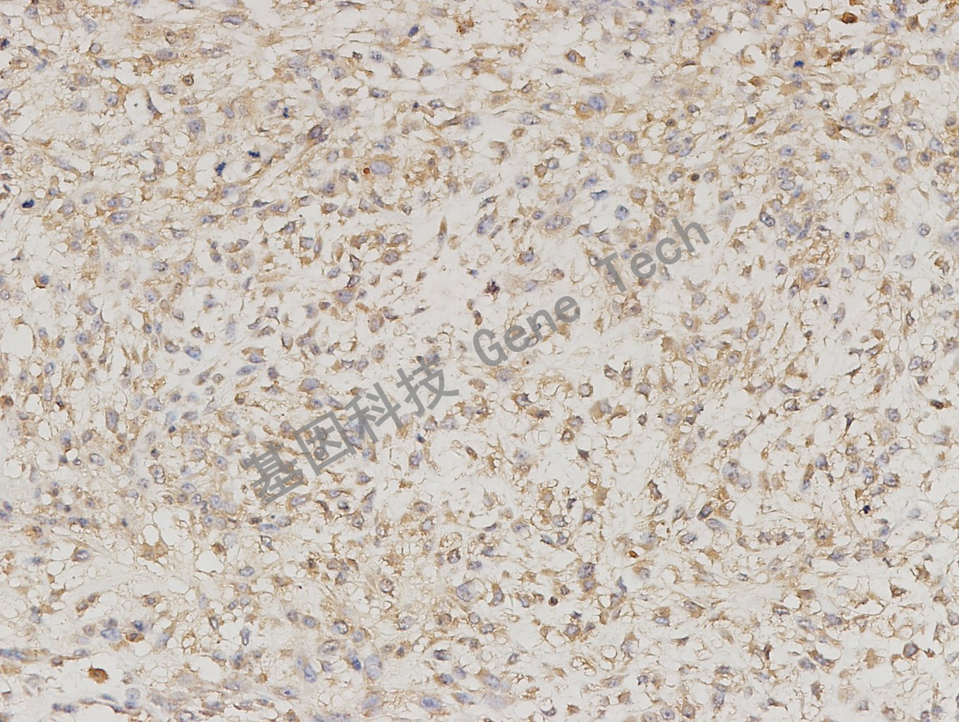 1595765557140447.jpg 20171225-7 骨肉瘤-2_副本.jpg