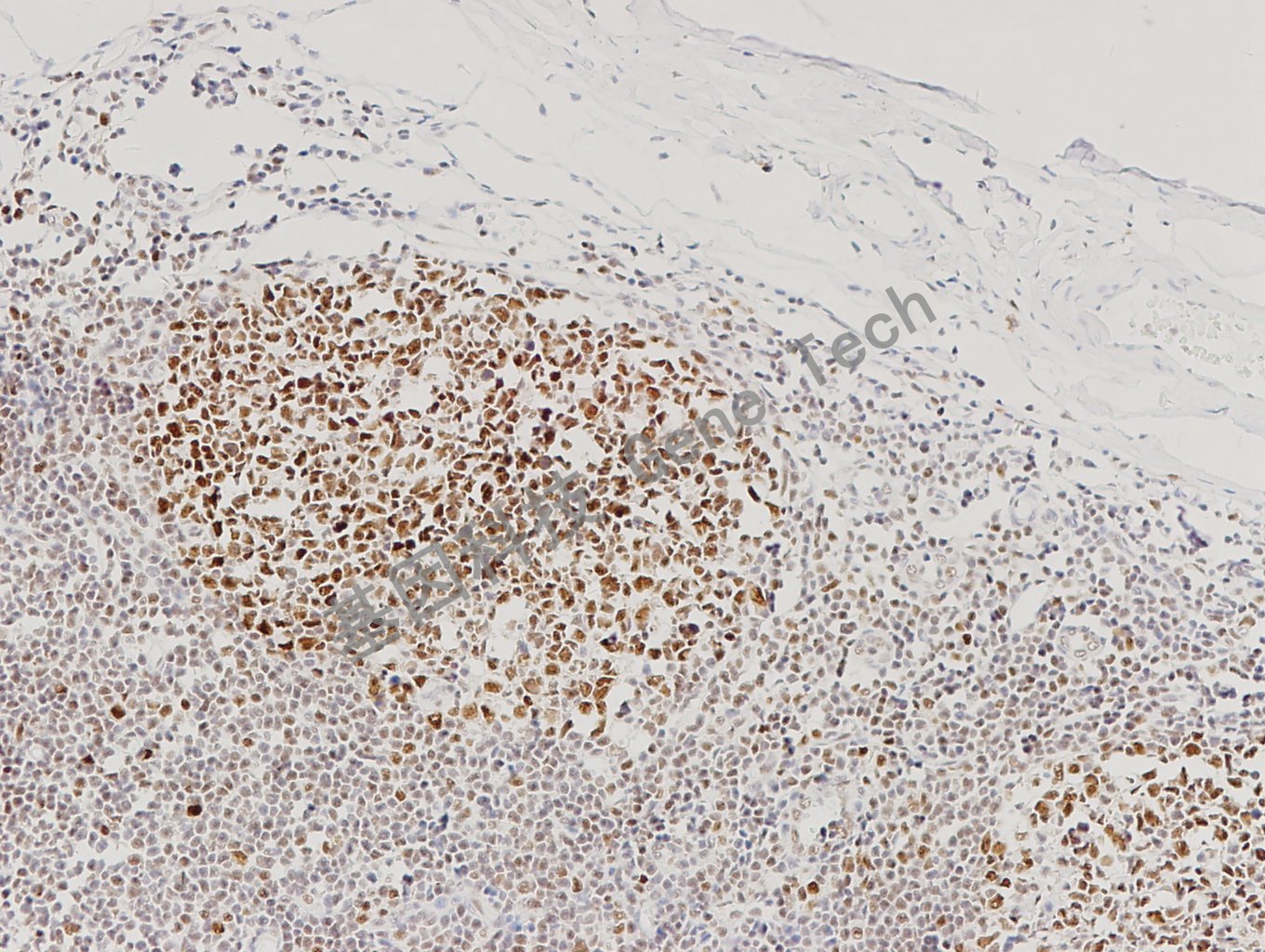 20171205-9 扁桃体 1：500_副本.jpg