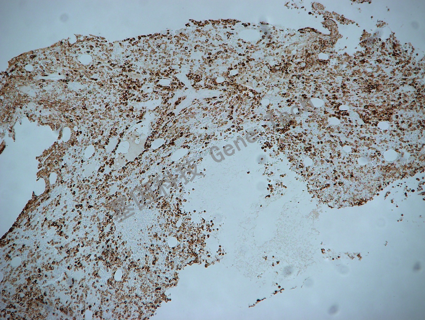 MPO GT2032 胞浆 骨髓10X_副本.jpg