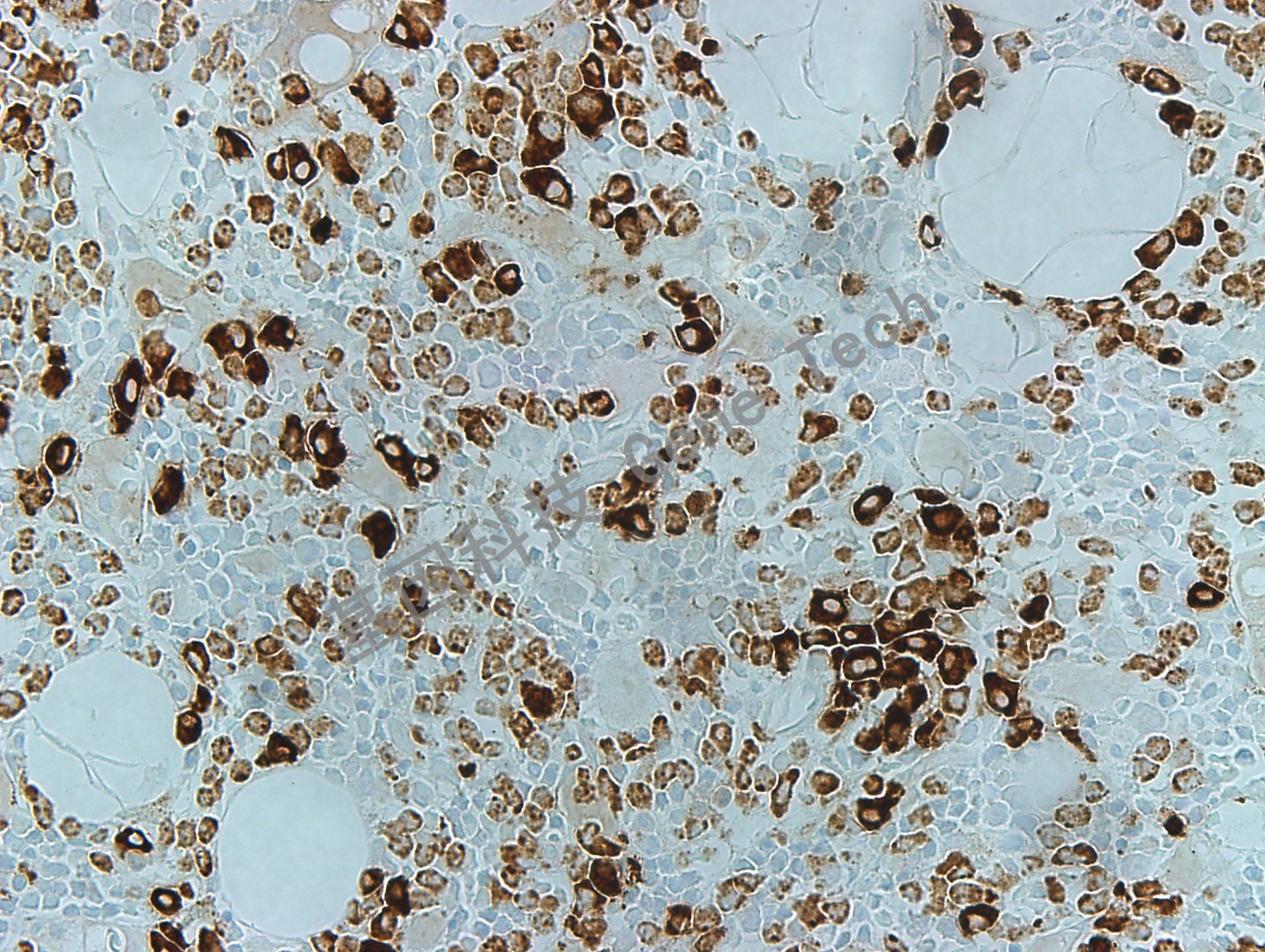 MPO GT2032 胞浆 骨髓40_副本.jpg