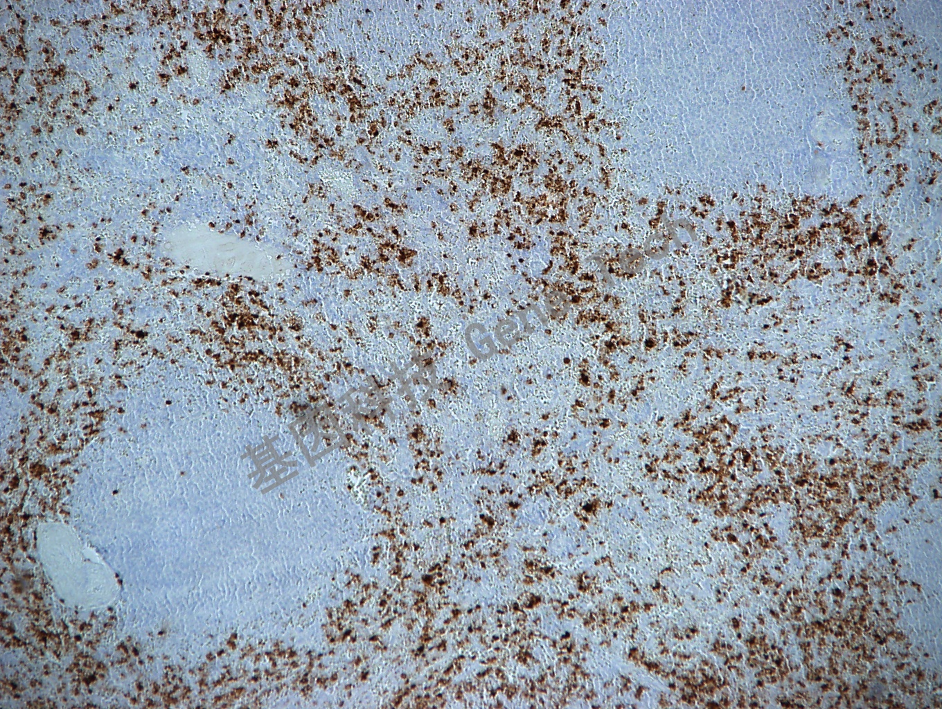 MPO GT2032 胞浆 脾10X_副本.jpg