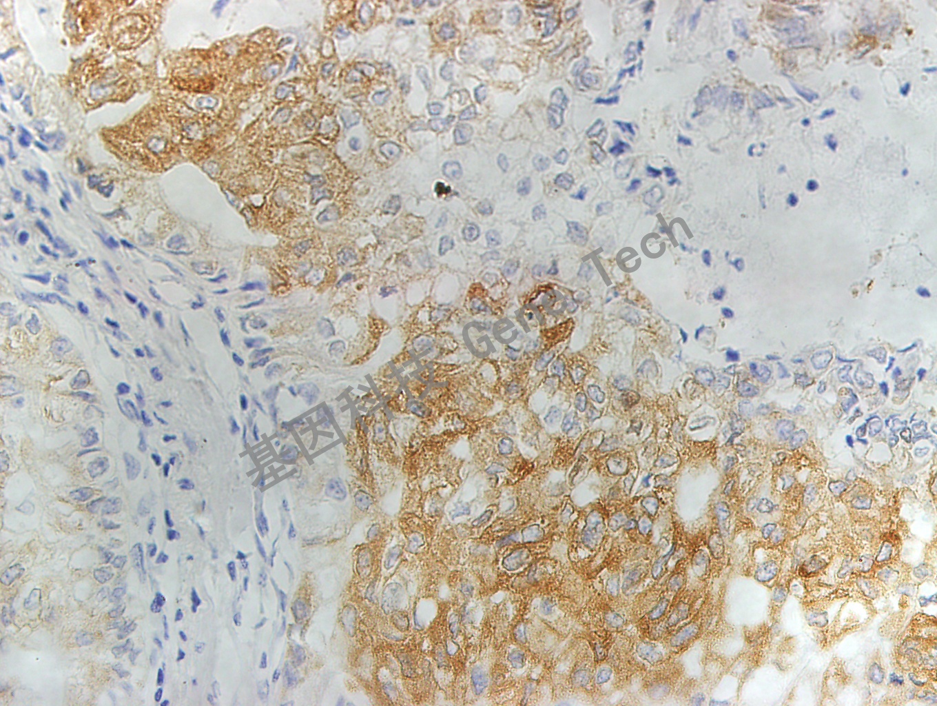 MRP1 GT2015 40X B5肺_副本.jpg