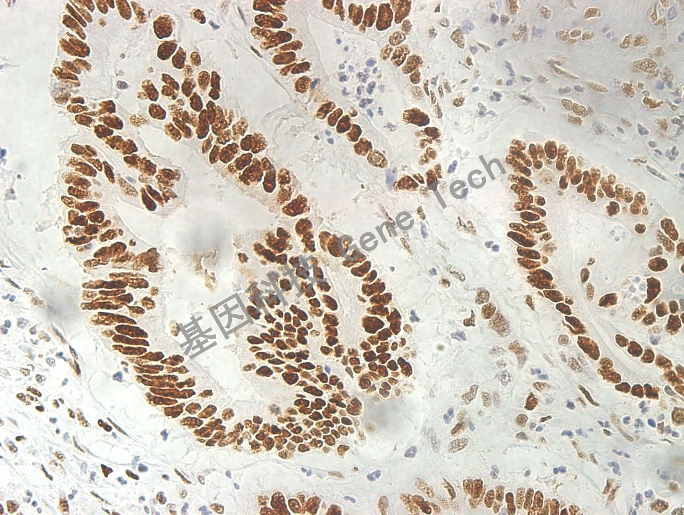 MSH6  GT2195 40X_副本.jpg