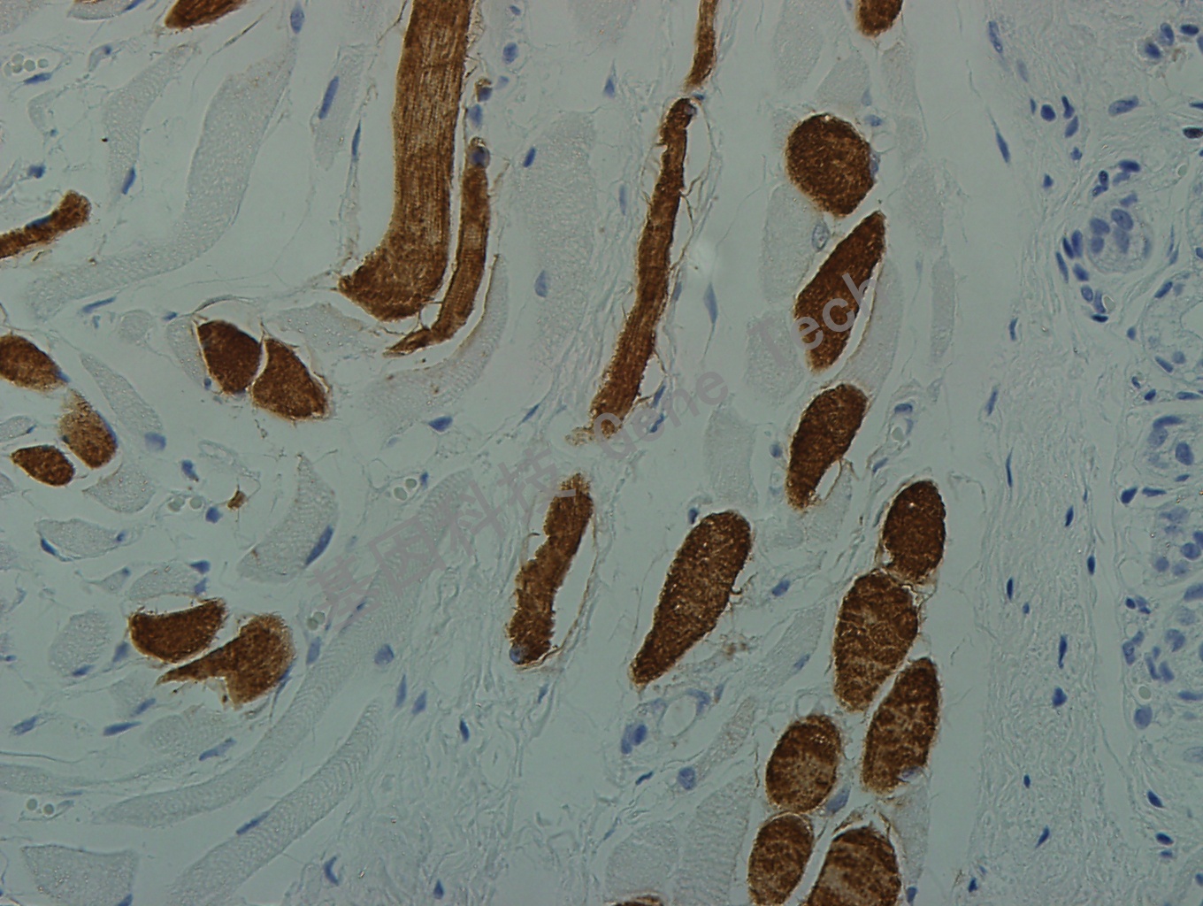 Myosin sk 40X 扁桃体中骨骼肌_副本.jpg