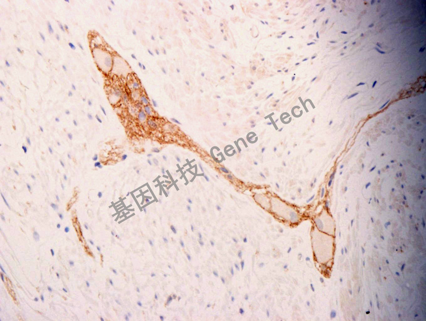 N-cad GT2268 阑尾 40X_副本.jpg