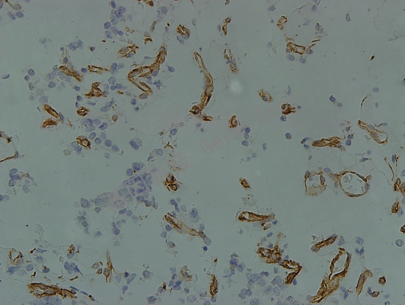 nestin GT2198 40X 垂体腺瘤_副本.jpg