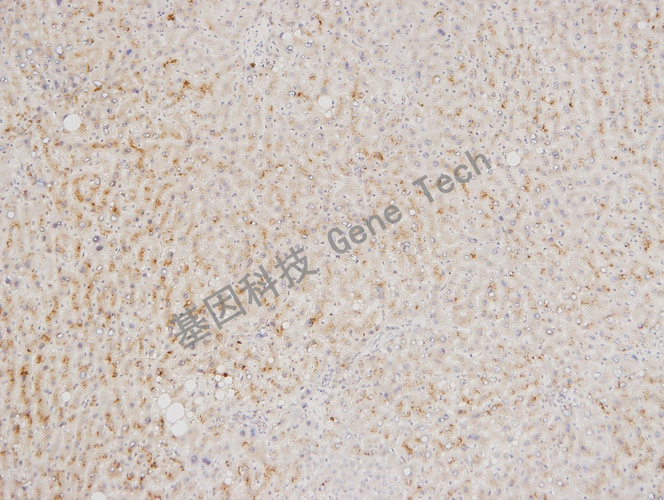 1595786707721341.jpg 20180125-8 07-T21 肝_副本.jpg