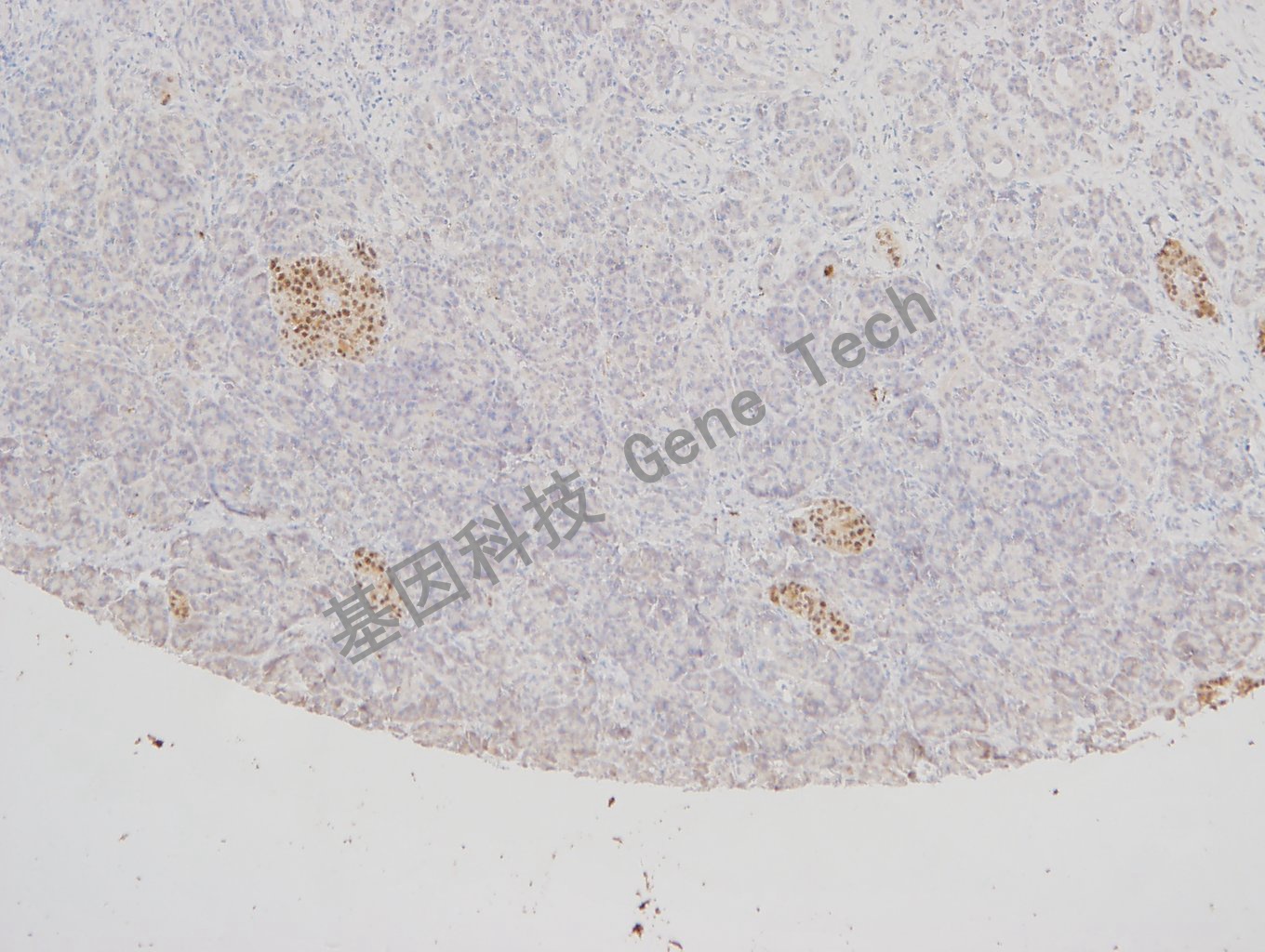 1595786748215933.jpg 20180125-8 07-T21 胰腺-1_副本.jpg