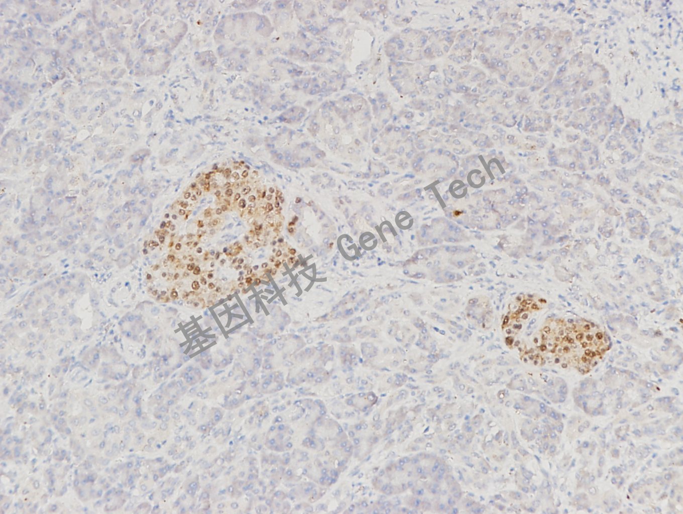 20180125-8 07-T21 胰腺-2_副本.jpg