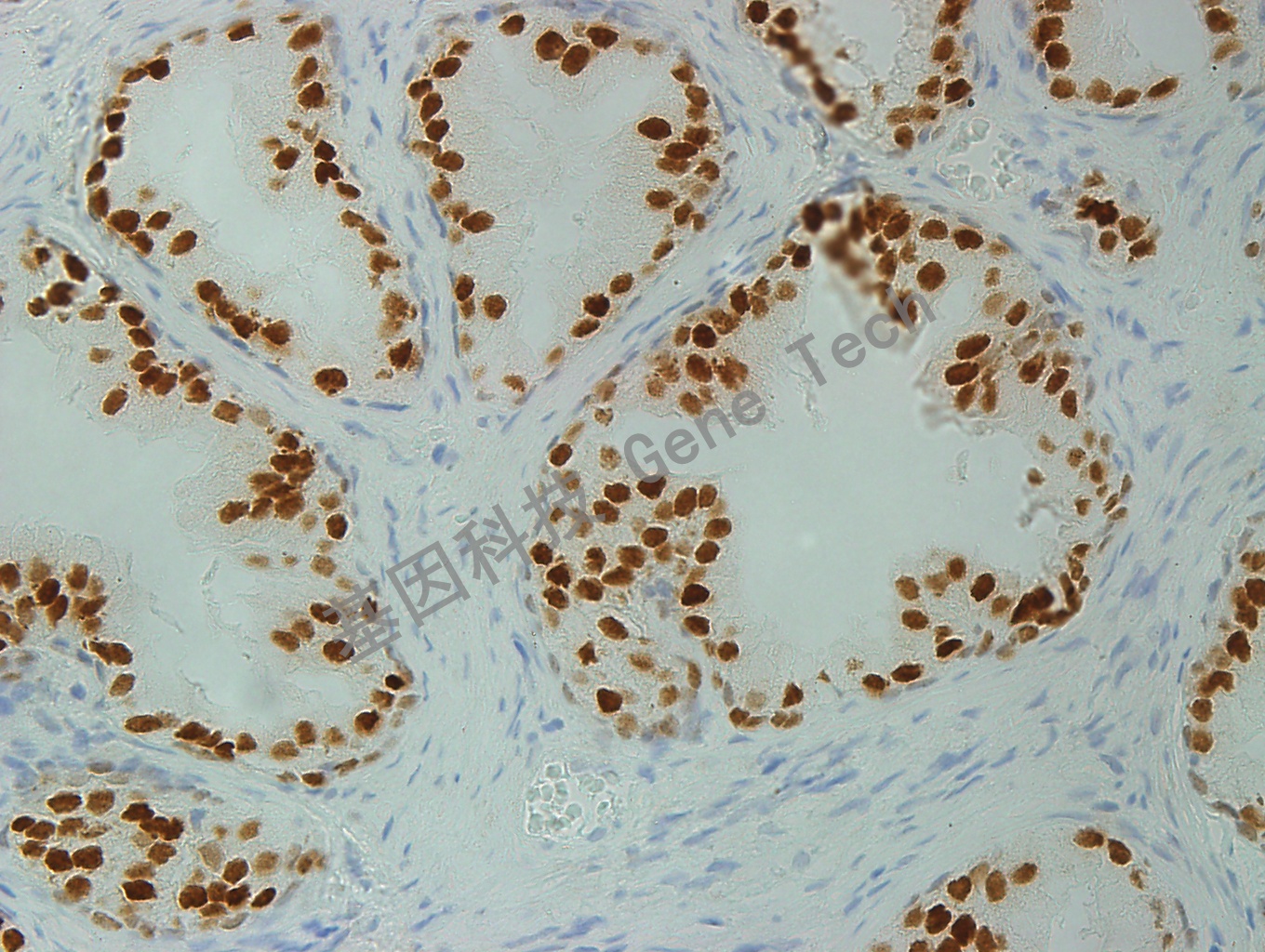 NKX3.1 GT2260 CKH-T1 2000 40X_副本.jpg