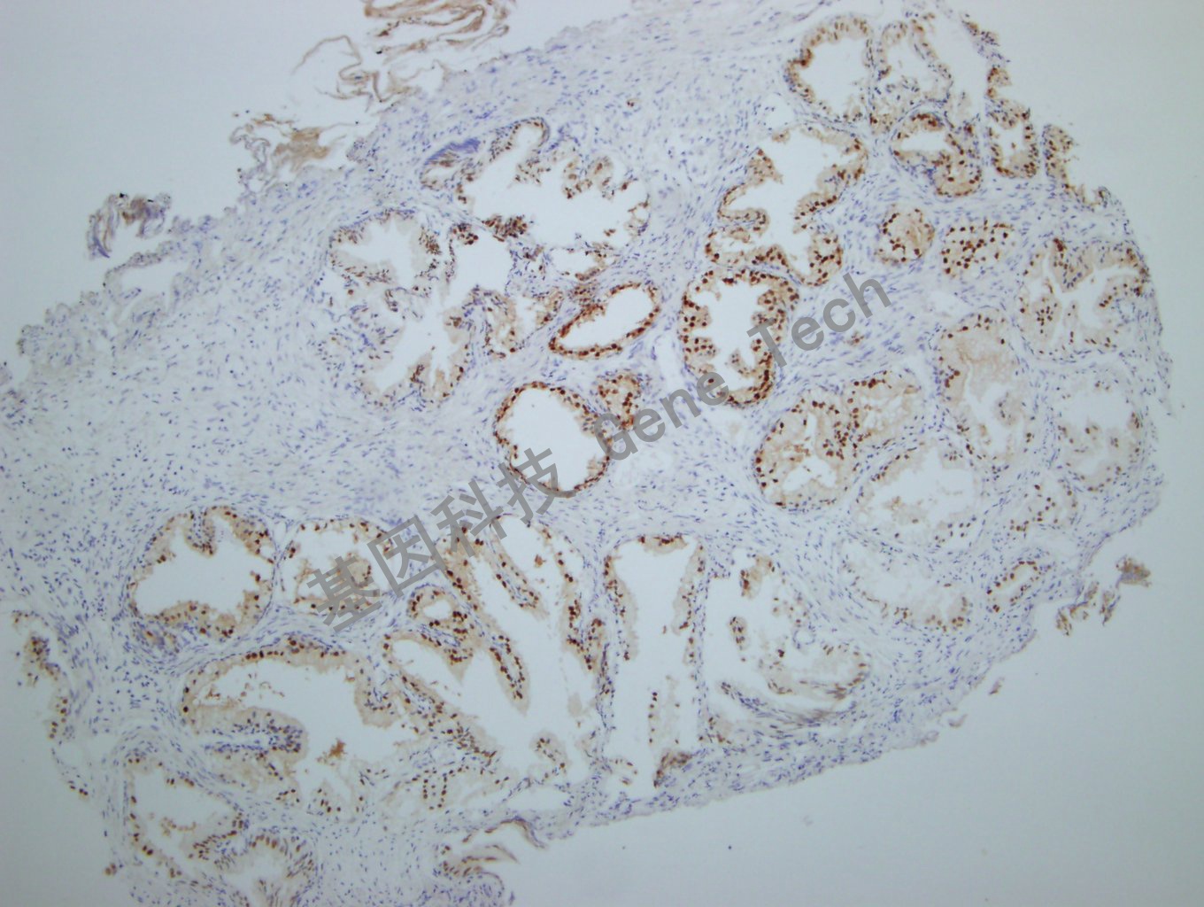 NKX3.1 GT2260 前列腺-10X_副本.jpg