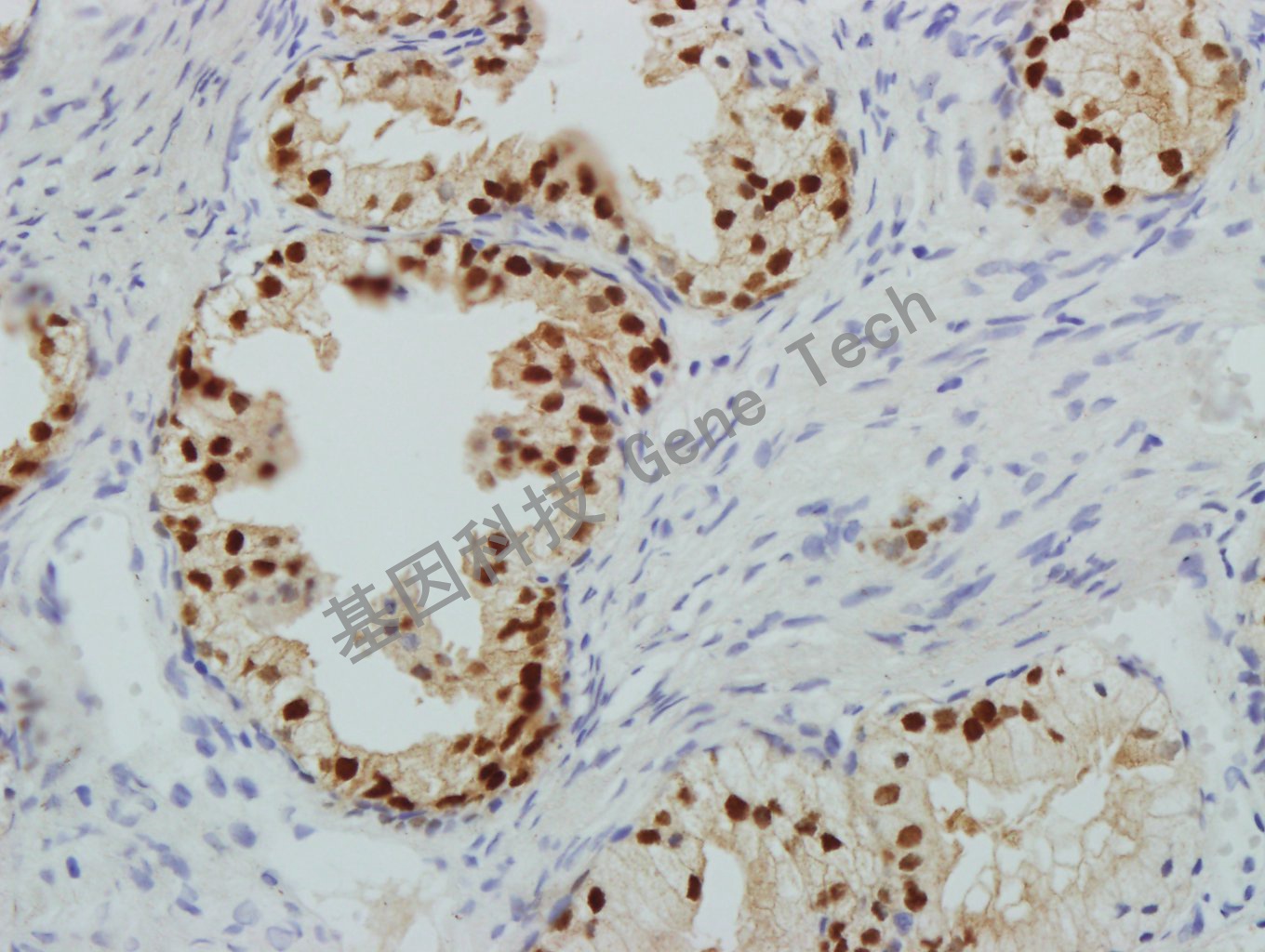 NKX3.1 GT2260 前列腺-40X_副本.jpg