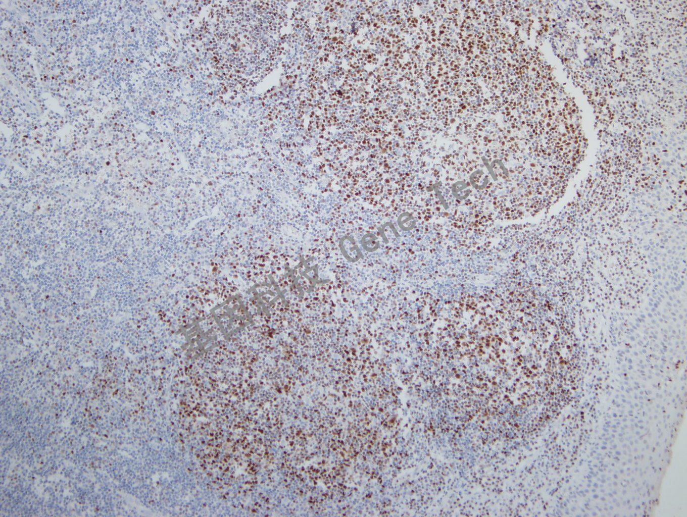 20181113-5 W26-1 扁桃体_副本.jpg