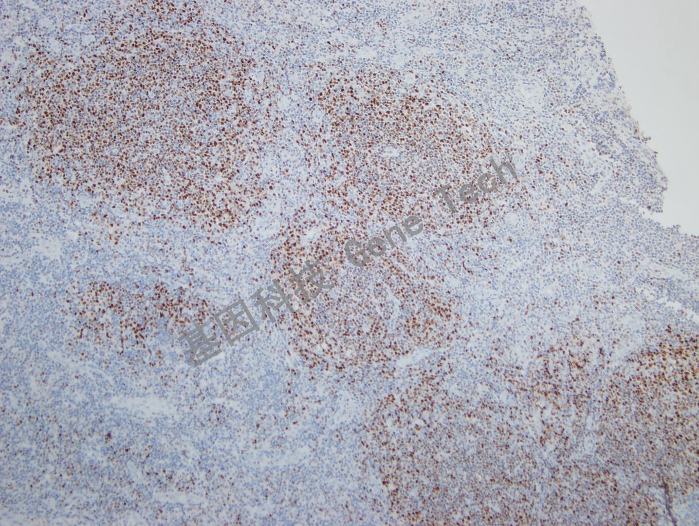 20181113-5 W26-2 扁桃体_副本.jpg