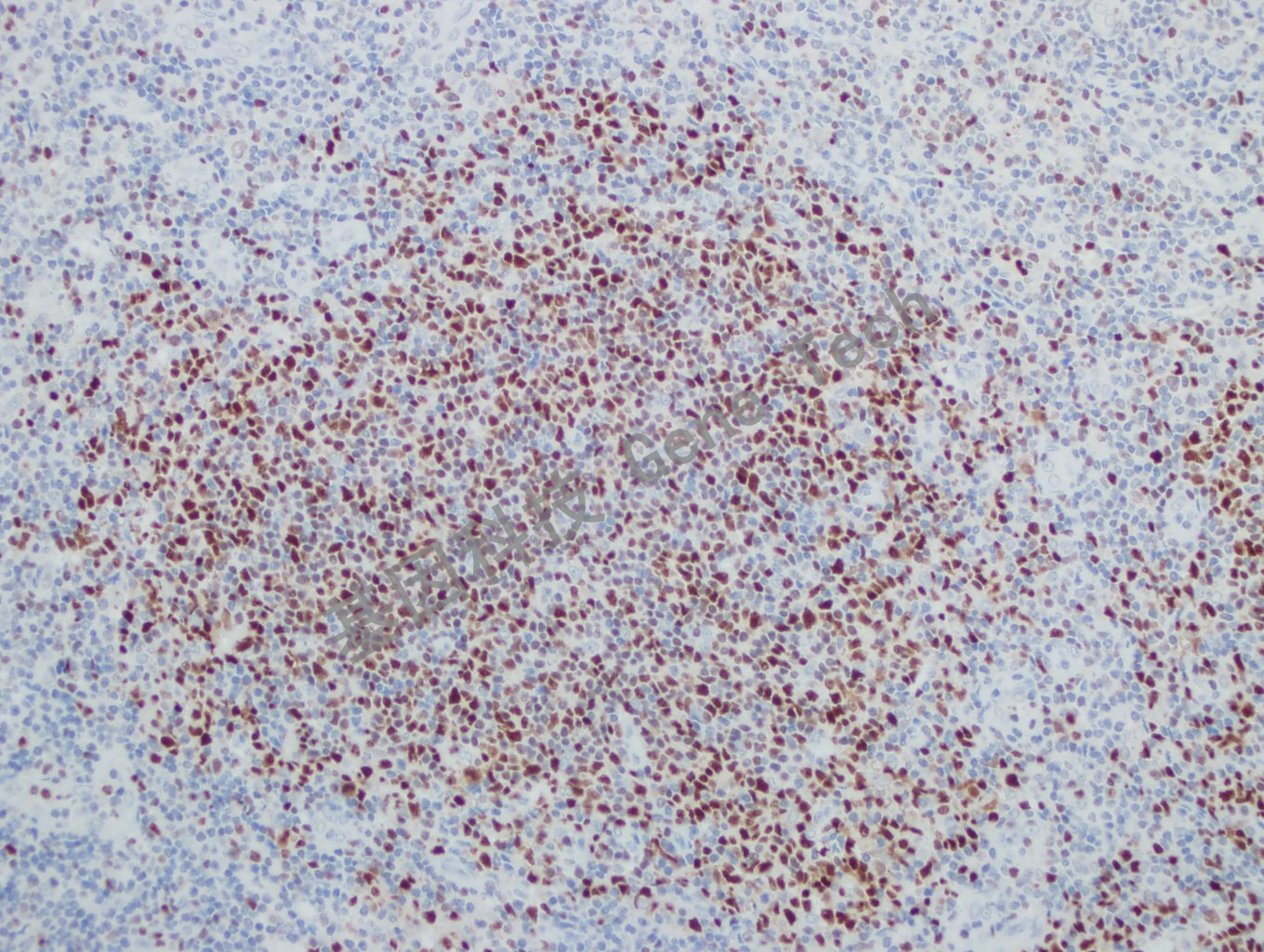 20181113-5 W26-3 扁桃体_副本.jpg