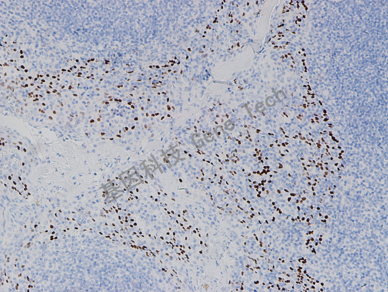 20180420-8 07-T21 扁桃体-2_副本.jpg