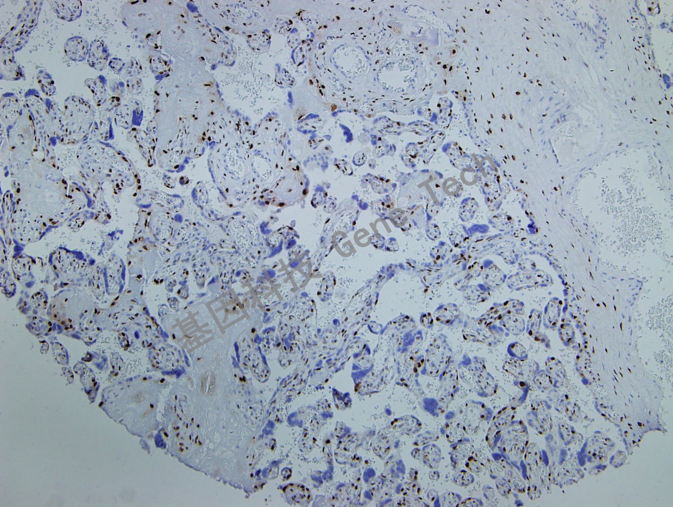 p57 GT2069_副本.jpg