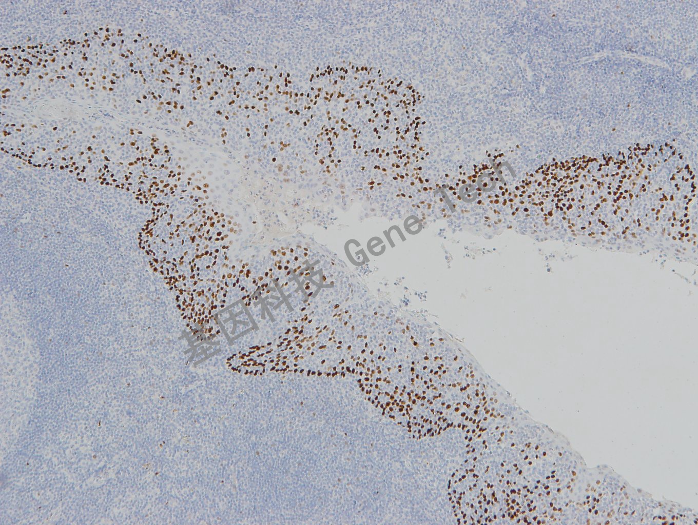 20190313-21 P63 W42-1 扁桃体-1_副本.jpg