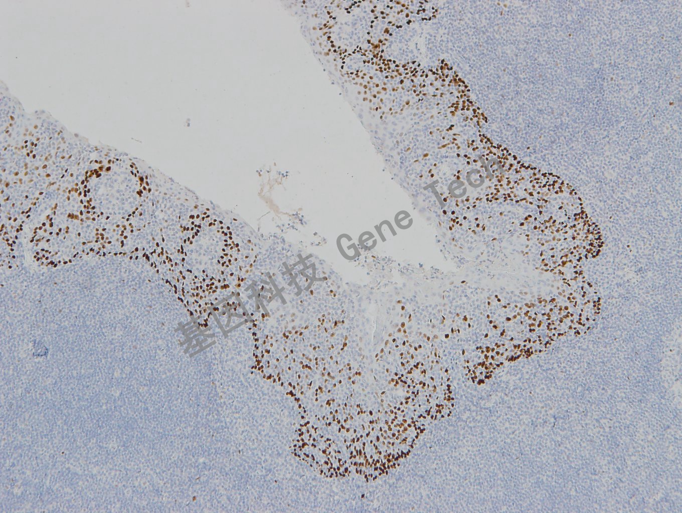 20190313-21 P63 W42-1 扁桃体-2_副本.jpg