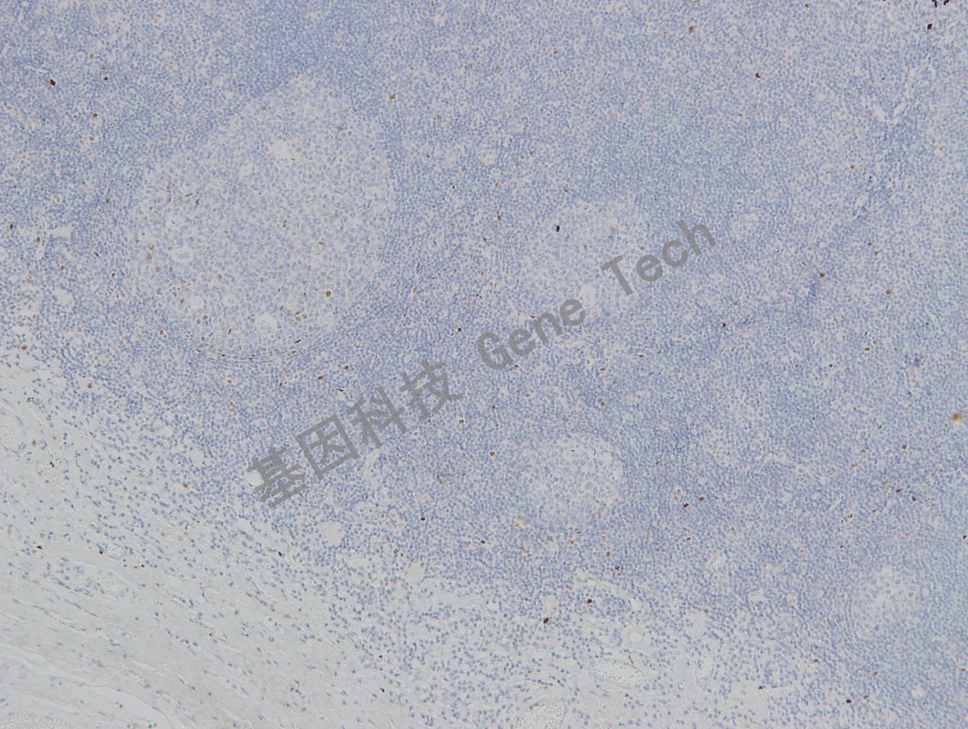 20190313-21 P63 W42-1 扁桃体-3_副本.jpg