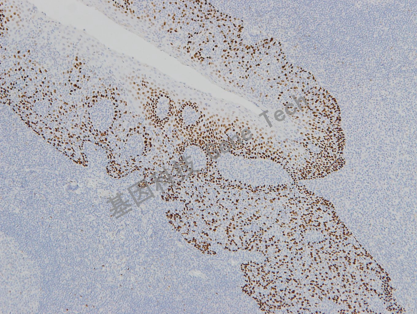 20190313-21 P63 W42-1 扁桃体-5_副本.jpg