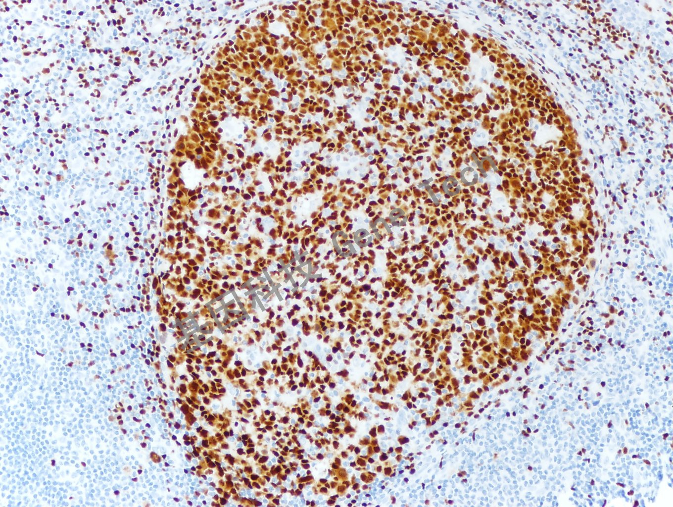 PAX-5 GT2096 扁桃体 20X 20190521-13_副本.jpg