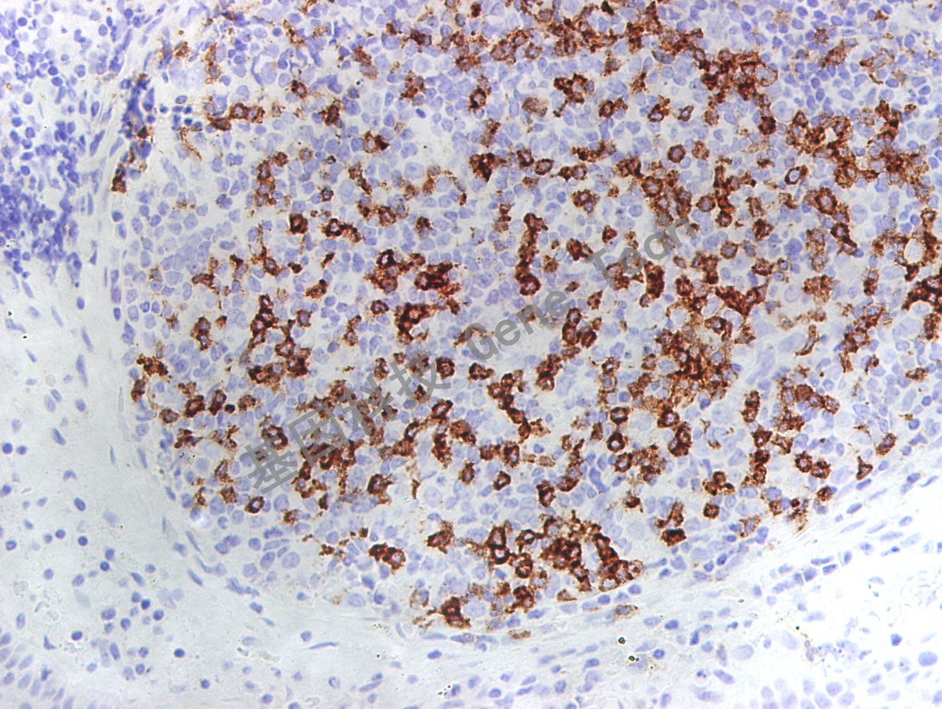 PD-1 GT2281 扁桃体 40X-2_副本.jpg