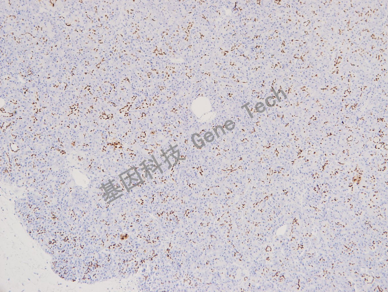 20180130-16 06-T4 胰腺-2_副本.jpg