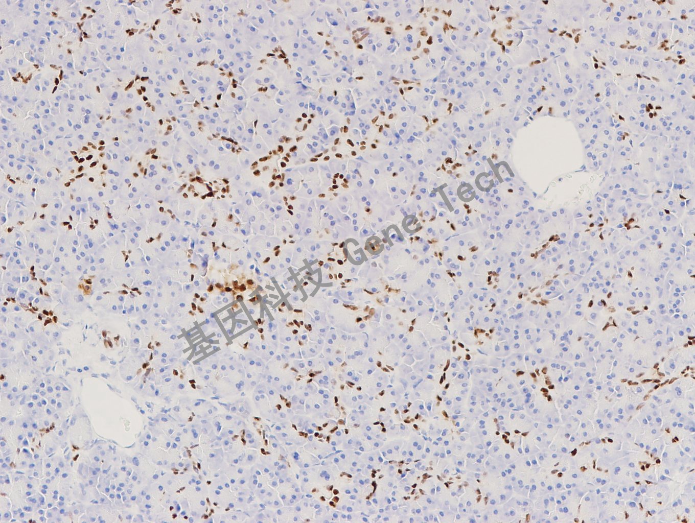 20180130-16 06-T4 胰腺-3_副本.jpg