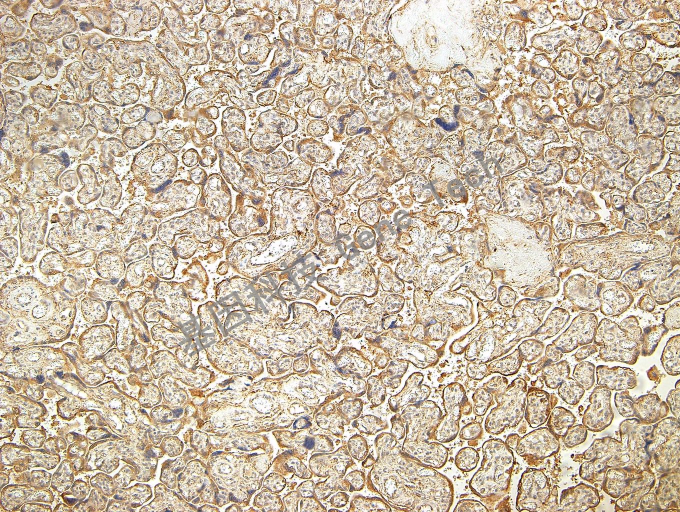 PI3K P85 GT2214 胎盘 胞浆_副本.jpg