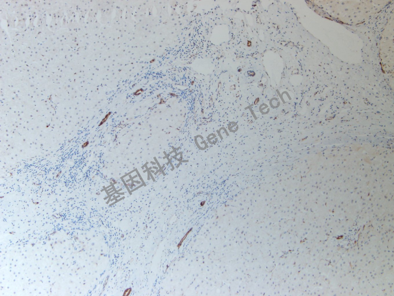 20200507-18 HSP70 G15-2_副本.jpg