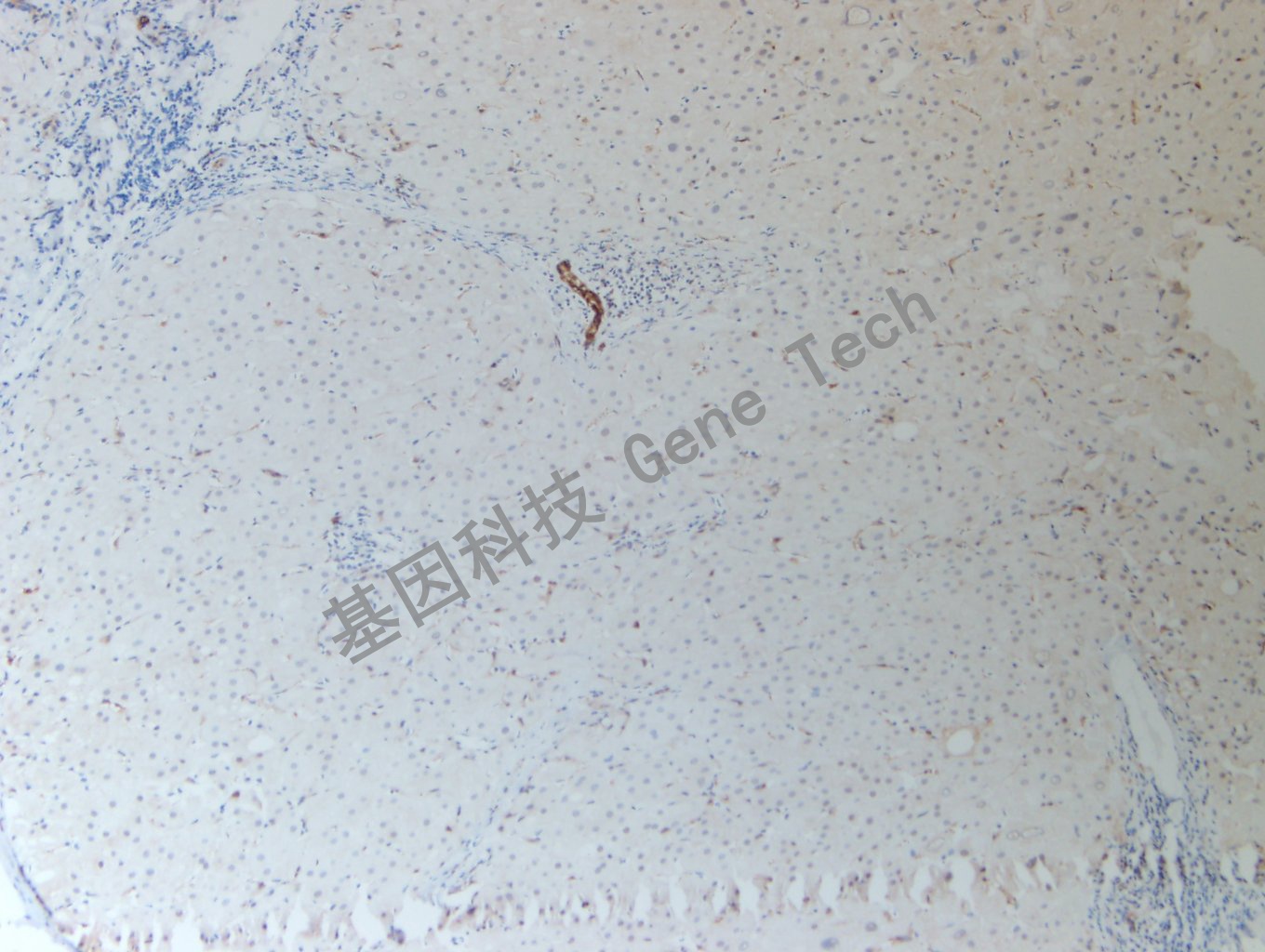 20200507-18 HSP70 G15-3_副本.jpg