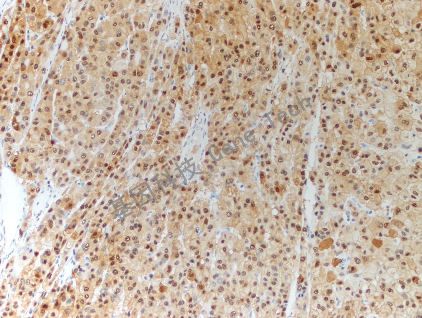 20200507-19 HSP70 G17 -2_副本.jpg