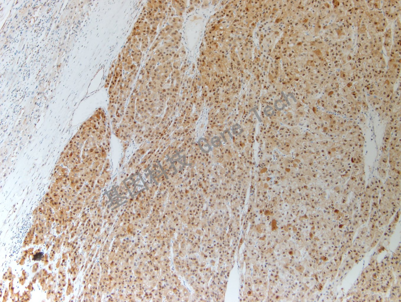 20200507-19 HSP70 G17_副本.jpg