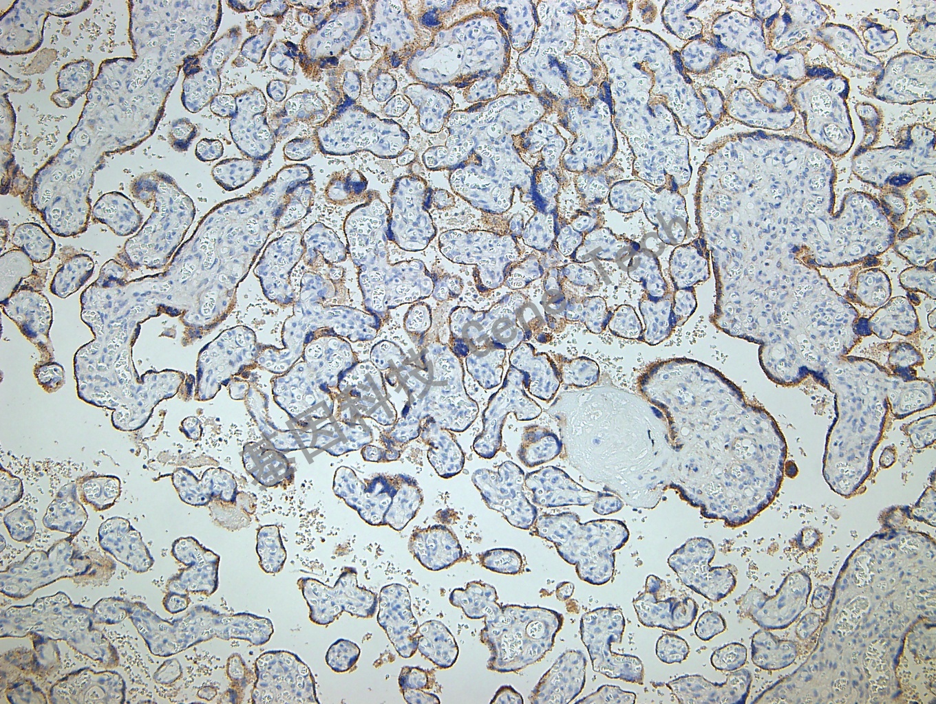 1596102569928625.jpg GLP3 GT2068 胎盘 10X_副本.jpg