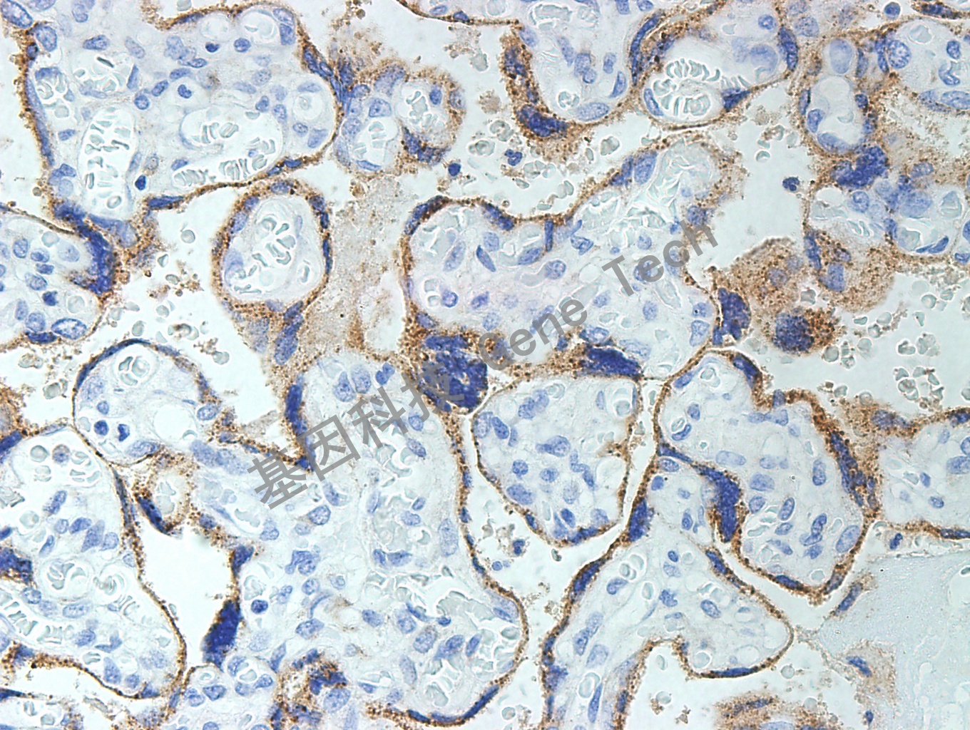 1596102577895061.jpg GLP3 GT2068 胎盘 40X_副本.jpg