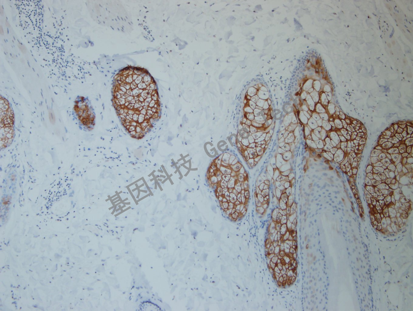 CK10  BE2 皮肤 20200819-2-3 -1_副本.jpg