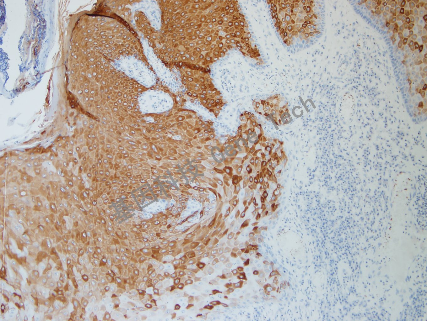 CK10  BE2 皮肤 20200819-2-3 BE2 -2_副本.jpg