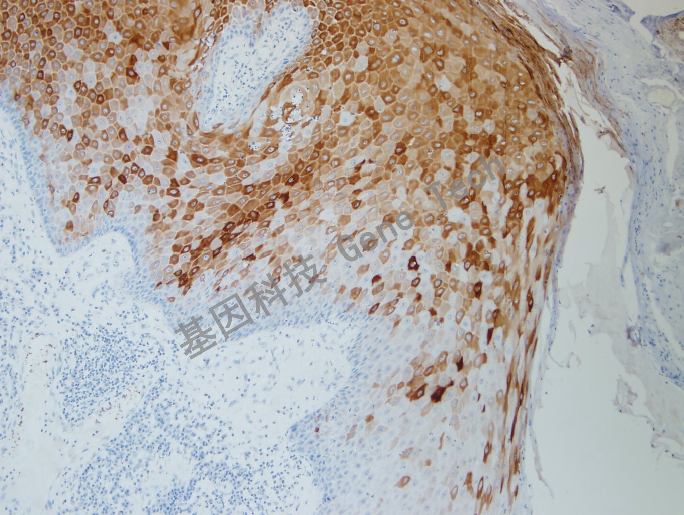 CK10  BE2 皮肤 20200819-2-3 BE2 -3_副本.jpg