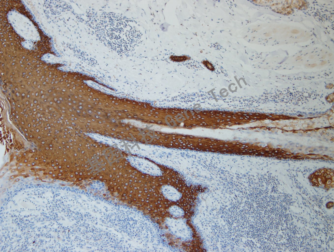 CK10  BE2 皮肤 20200819-2-4 BE2 -2_副本.jpg