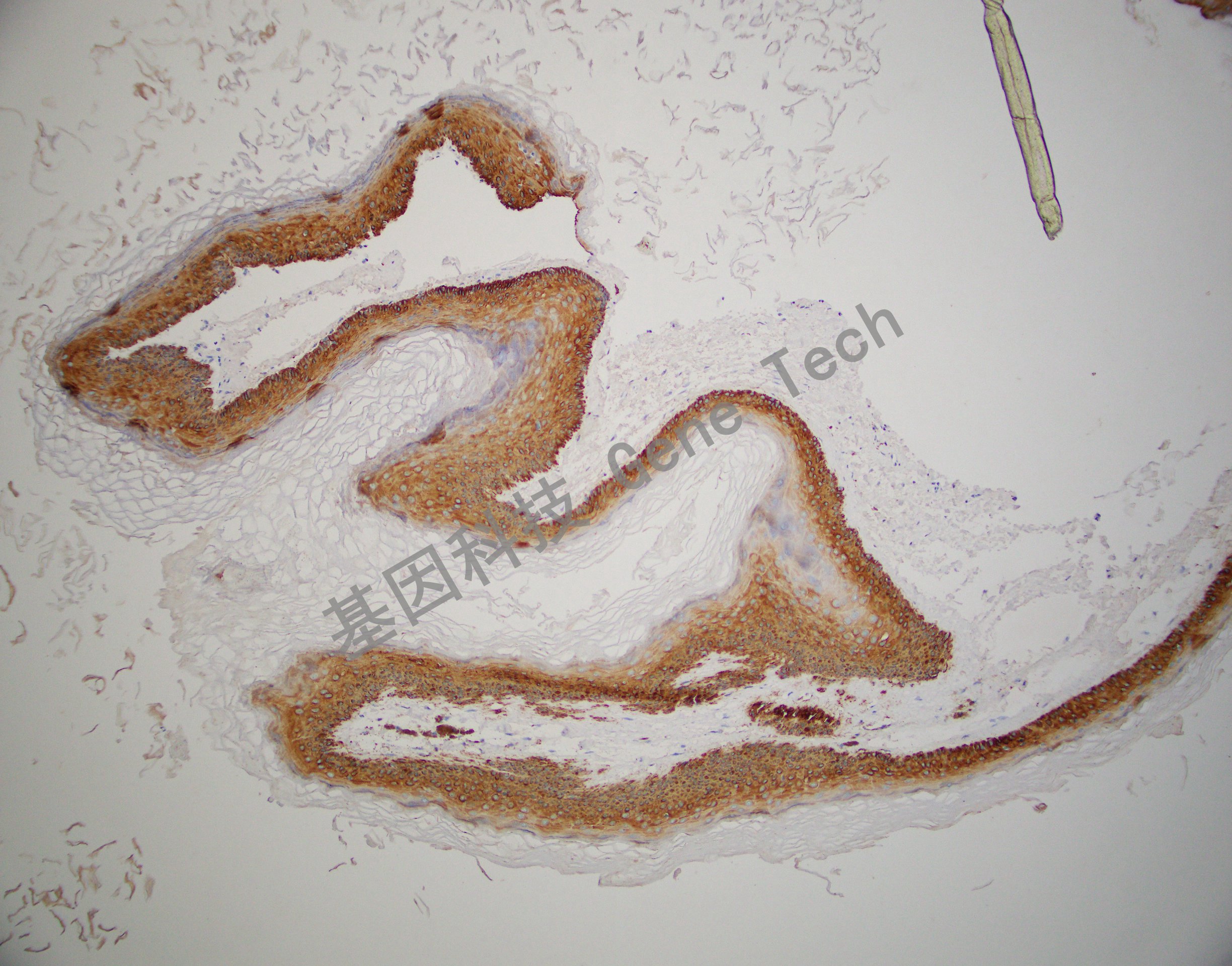 CK14   BE13 皮肤 20201111-7  -2_副本.jpg